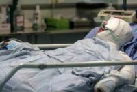 نبود بیمارستان سوختگی، چالش بزرگ نظام سلامت سمنان