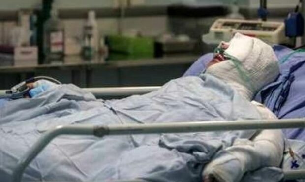 نبود بیمارستان سوختگی، چالش بزرگ نظام سلامت سمنان